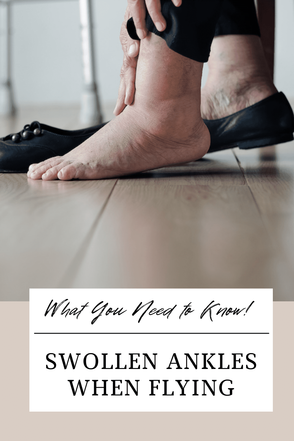 Swollen Ankles when Flying pin