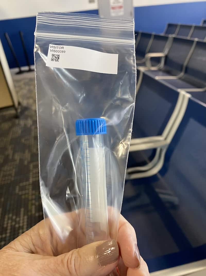 Non-invasive PCR test